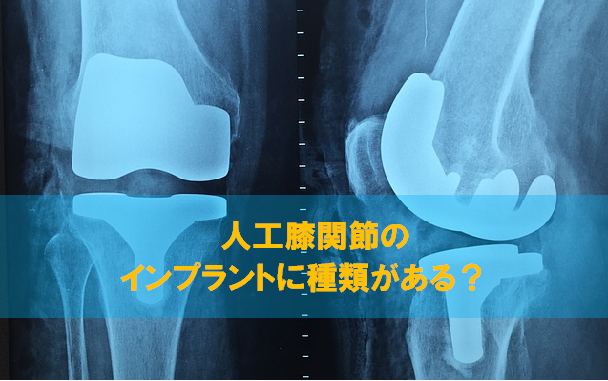 人工膝関節置換術（TKA）のインプラントに種類がある？ | リハビリの一助となりますように