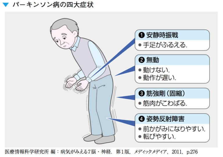 「仮面の顔」とはどういう意味ですか?